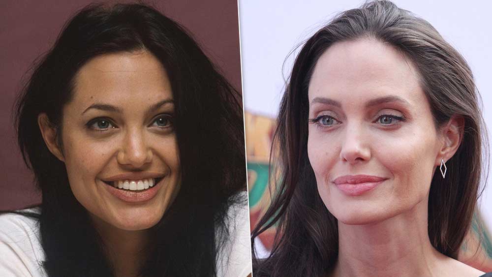 актрисы +до и после пластики фото