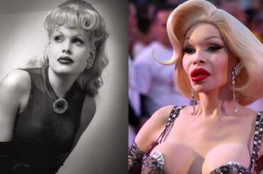 жертвы пластической хирургии